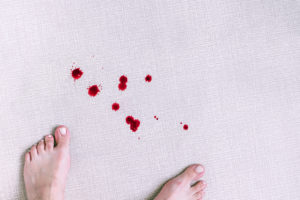 how to get blood out of carpet